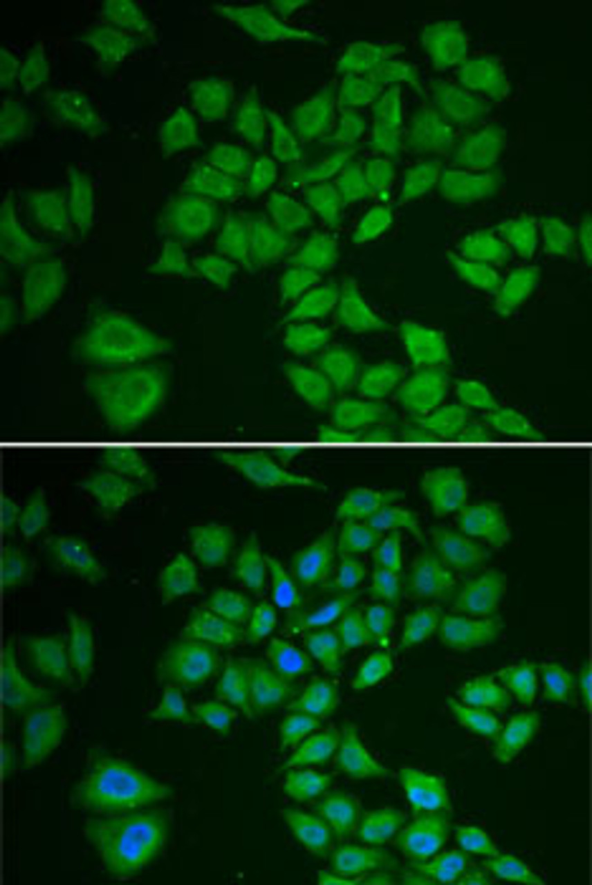 Immunofluorescence analysis of A-549 cells using HMGCR antibody (14-912) . Blue: DAPI for nuclear staining.