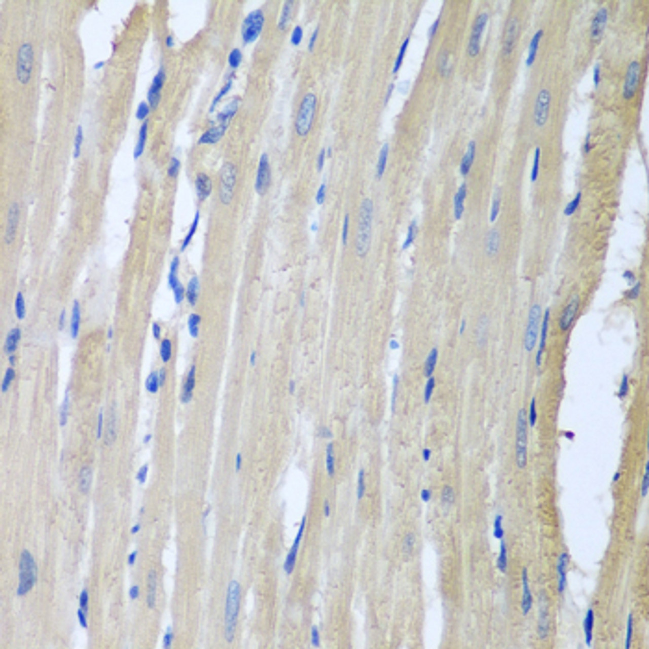 Immunohistochemistry of paraffin-embedded rat heart using LRP6 antibody (14-920) at dilution of 1:100 (40x lens) .