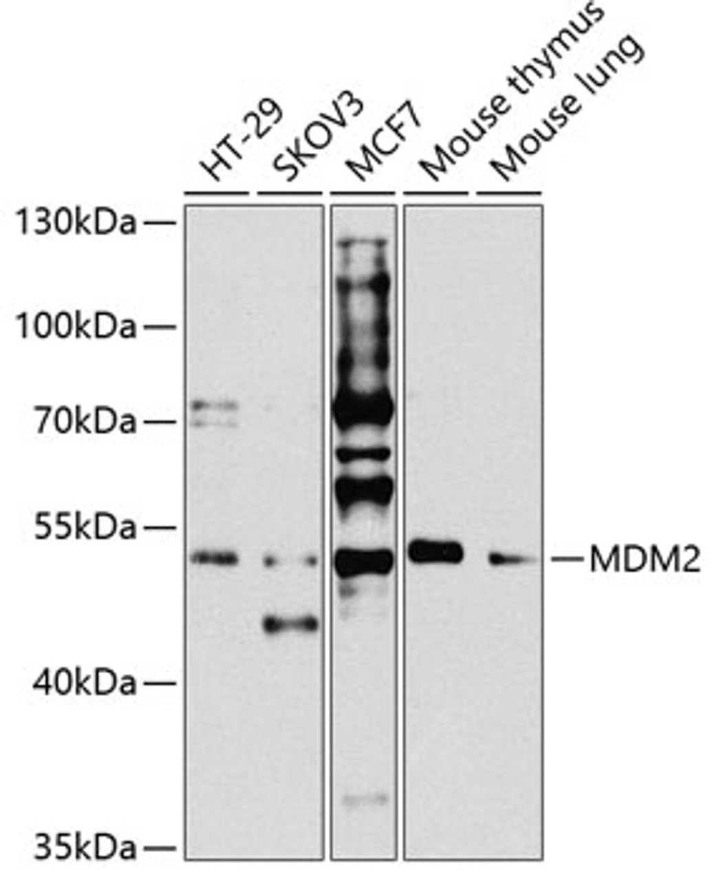Western blot analysis of extracts of various cell lines, using MDM2 antibody (14-921) at 1:1000 dilution.<br/>Secondary antibody: HRP Goat Anti-Rabbit IgG (H+L) at 1:10000 dilution.<br/>Lysates/proteins: 25ug per lane.<br/>Blocking buffer: 3% nonfat dry milk in TBST.<br/>Detection: ECL Basic Kit.<br/>Exposure time: 90s.