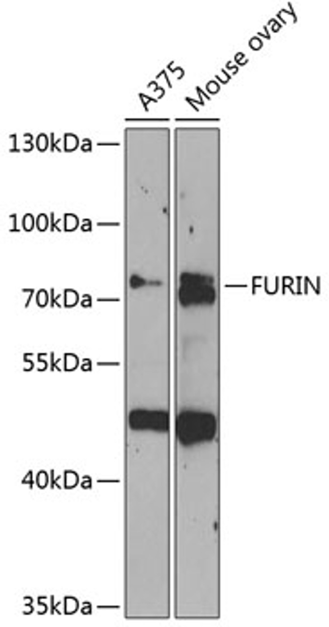 Western blot analysis of extracts of various cell lines, using FURIN antibody (14-925) at 1:1000 dilution.<br/>Secondary antibody: HRP Goat Anti-Rabbit IgG (H+L) at 1:10000 dilution.<br/>Lysates/proteins: 25ug per lane.<br/>Blocking buffer: 3% nonfat dry milk in TBST.<br/>Detection: ECL Enhanced Kit.<br/>Exposure time: 90s.