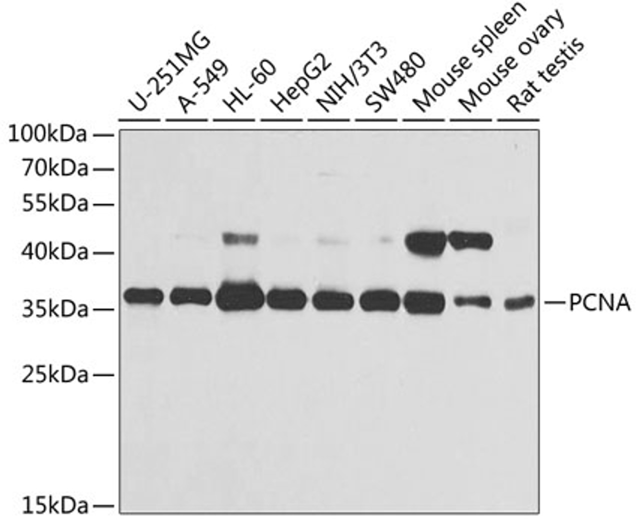 Western blot analysis of extracts of various cell lines, using PCNA antibody (14-926) at 1:1000 dilution.<br/>Secondary antibody: HRP Goat Anti-Rabbit IgG (H+L) at 1:10000 dilution.<br/>Lysates/proteins: 25ug per lane.<br/>Blocking buffer: 3% nonfat dry milk in TBST.<br/>Detection: ECL Basic Kit.<br/>Exposure time: 10s.