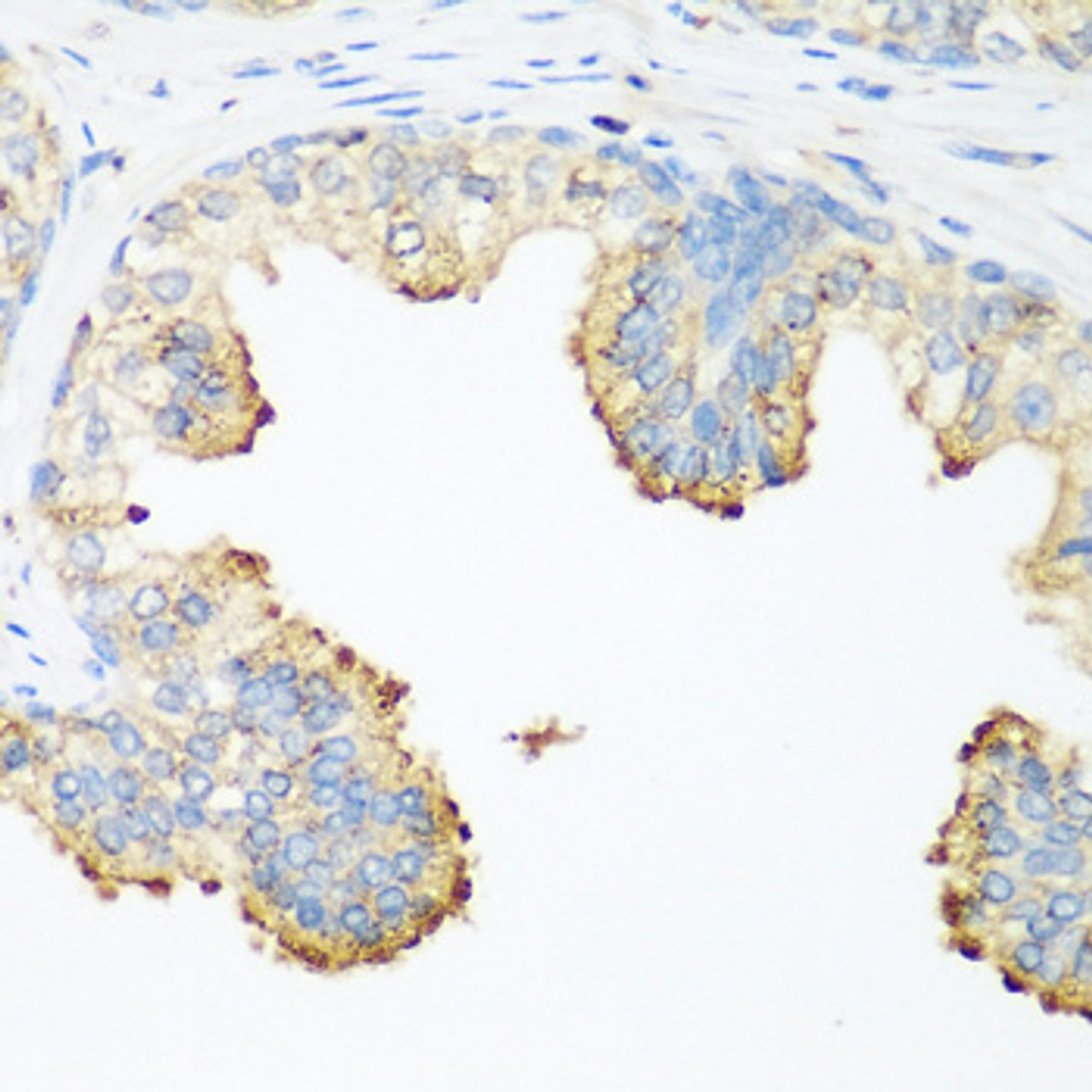 Immunohistochemistry of paraffin-embedded human prostate using PLEK antibody (14-928) at dilution of 1:200 (40x lens) .