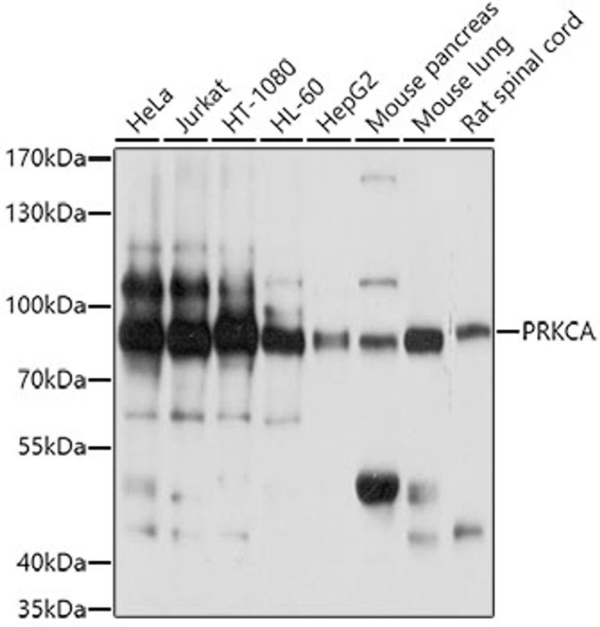 Western blot analysis of extracts of various cell lines, using PRKCA antibody (14-932) at 1:1000 dilution.<br/>Secondary antibody: HRP Goat Anti-Rabbit IgG (H+L) at 1:10000 dilution.<br/>Lysates/proteins: 25ug per lane.<br/>Blocking buffer: 3% nonfat dry milk in TBST.<br/>Detection: ECL Basic Kit.<br/>Exposure time: 1s.