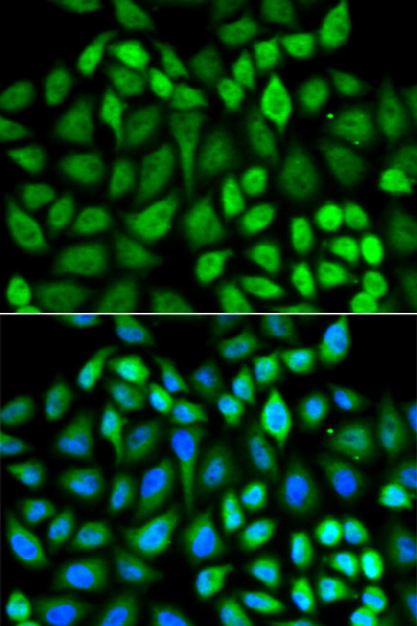 Immunofluorescence analysis of U2OS cells using MAPK3 antibody (14-933) . Blue: DAPI for nuclear staining.