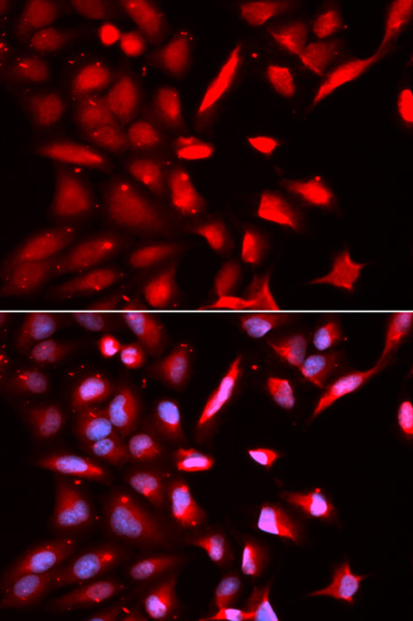 Immunofluorescence analysis of U2OS cells using PSMC3 antibody (14-934) . Blue: DAPI for nuclear staining.
