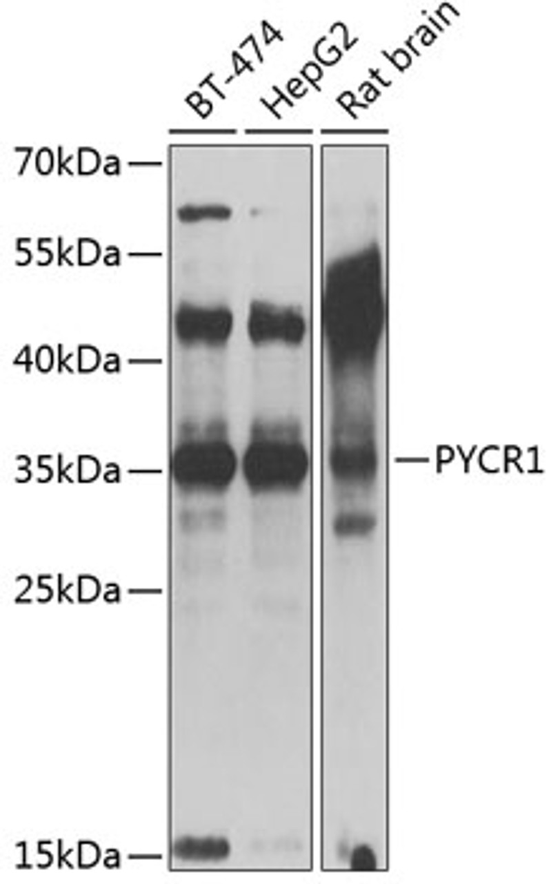 Western blot analysis of extracts of various cell lines, using PYCR1 antibody (14-935) at 1:1000 dilution.<br/>Secondary antibody: HRP Goat Anti-Rabbit IgG (H+L) at 1:10000 dilution.<br/>Lysates/proteins: 25ug per lane.<br/>Blocking buffer: 3% nonfat dry milk in TBST.<br/>Detection: ECL Basic Kit.<br/>Exposure time: 30s.