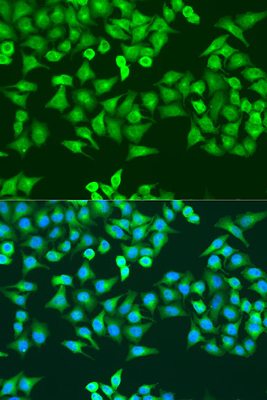 Immunofluorescence analysis of U2OS cells using RRM1 antibody (14-936) at dilution of 1:100. Blue: DAPI for nuclear staining.