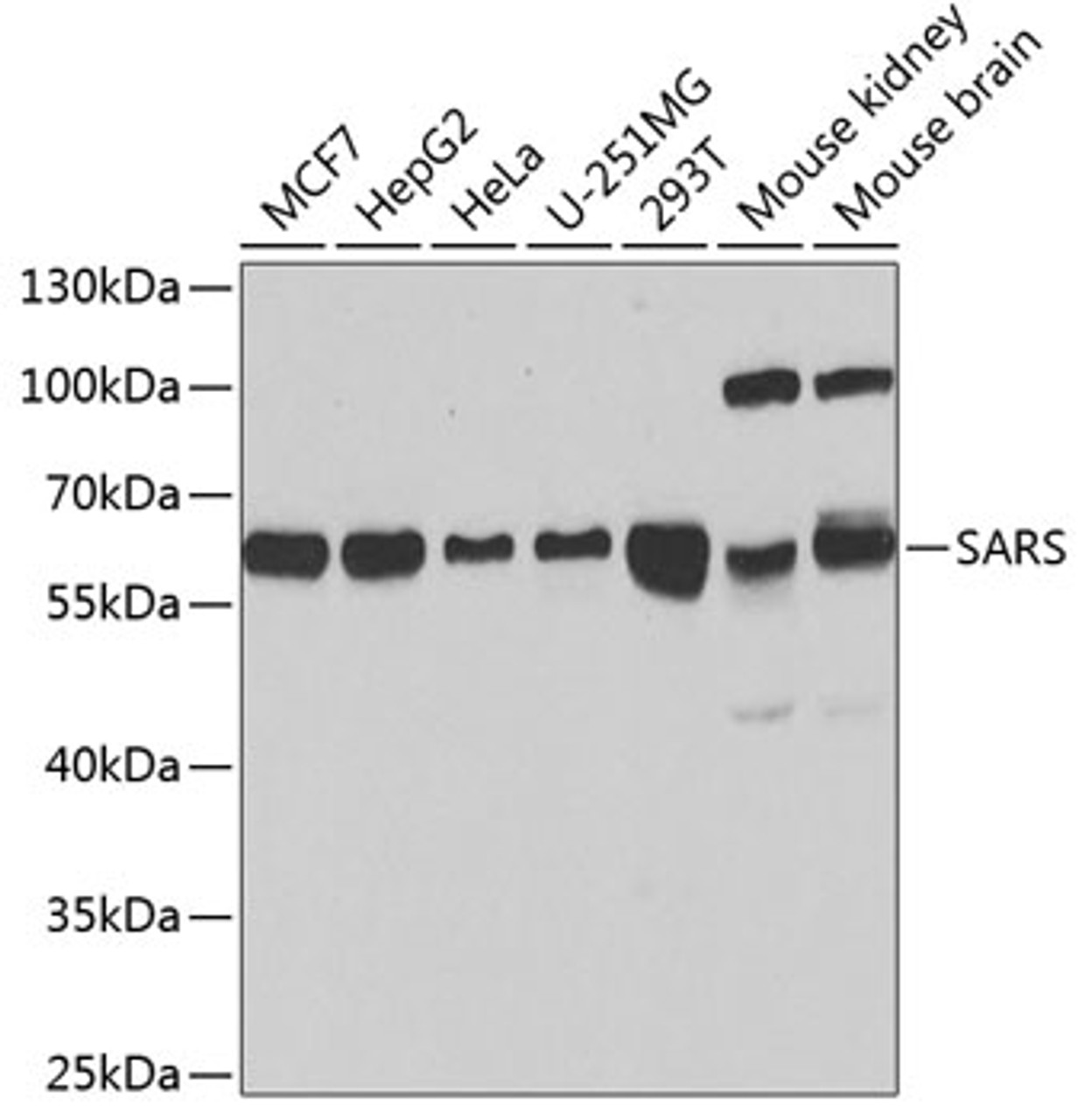 Western blot analysis of extracts of various cell lines, using SARS antibody (14-938) at 1:1000 dilution.<br/>Secondary antibody: HRP Goat Anti-Rabbit IgG (H+L) at 1:10000 dilution.<br/>Lysates/proteins: 25ug per lane.<br/>Blocking buffer: 3% nonfat dry milk in TBST.<br/>Detection: ECL Basic Kit.<br/>Exposure time: 90s.