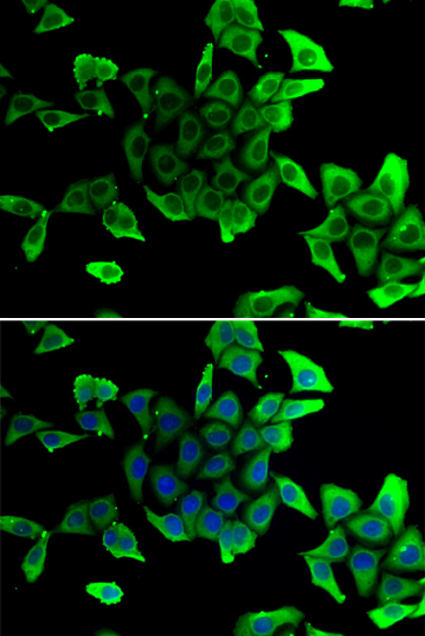 Immunofluorescence analysis of U2OS cells using SGCD antibody (14-939) . Blue: DAPI for nuclear staining.