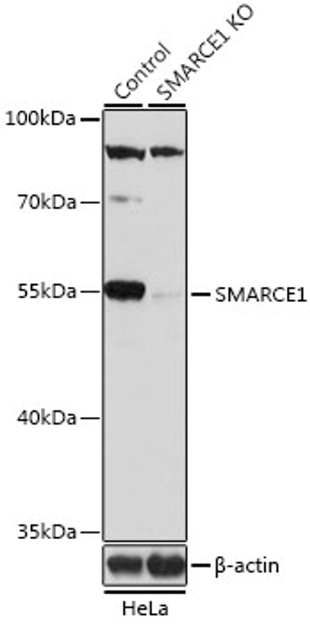 Western blot analysis of extracts from normal (control) and SMARCE1 knockout (KO) HeLa cells, using SMARCE1 antibody (14-940) at 1:1000 dilution.<br/>Secondary antibody: HRP Goat Anti-Rabbit IgG (H+L) at 1:10000 dilution.<br/>Lysates/proteins: 25ug per lane.<br/>Blocking buffer: 3% nonfat dry milk in TBST.<br/>Detection: ECL Basic Kit.<br/>Exposure time: 15s.