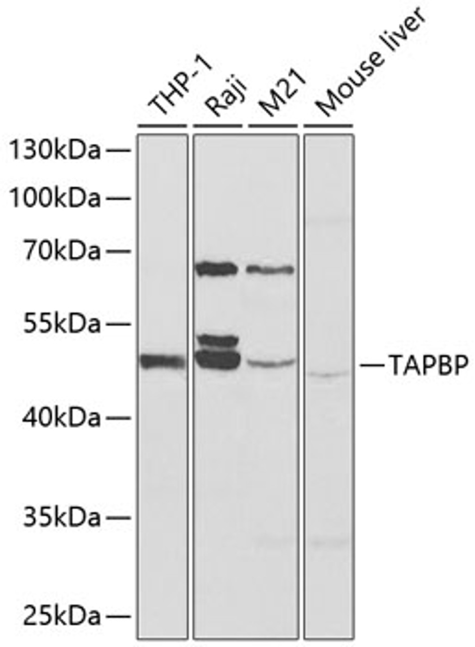 Western blot analysis of extracts of various cell lines, using TAPBP antibody (14-943) at 1:1000 dilution.<br/>Secondary antibody: HRP Goat Anti-Rabbit IgG (H+L) at 1:10000 dilution.<br/>Lysates/proteins: 25ug per lane.<br/>Blocking buffer: 3% nonfat dry milk in TBST.