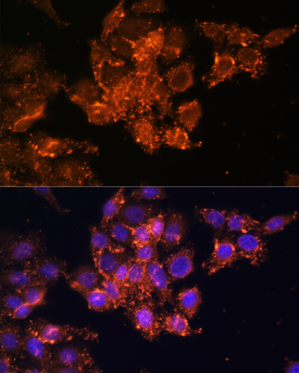 Immunofluorescence analysis of HeLa cells using TGM1 antibody (14-944) at dilution of 1:100. Blue: DAPI for nuclear staining.