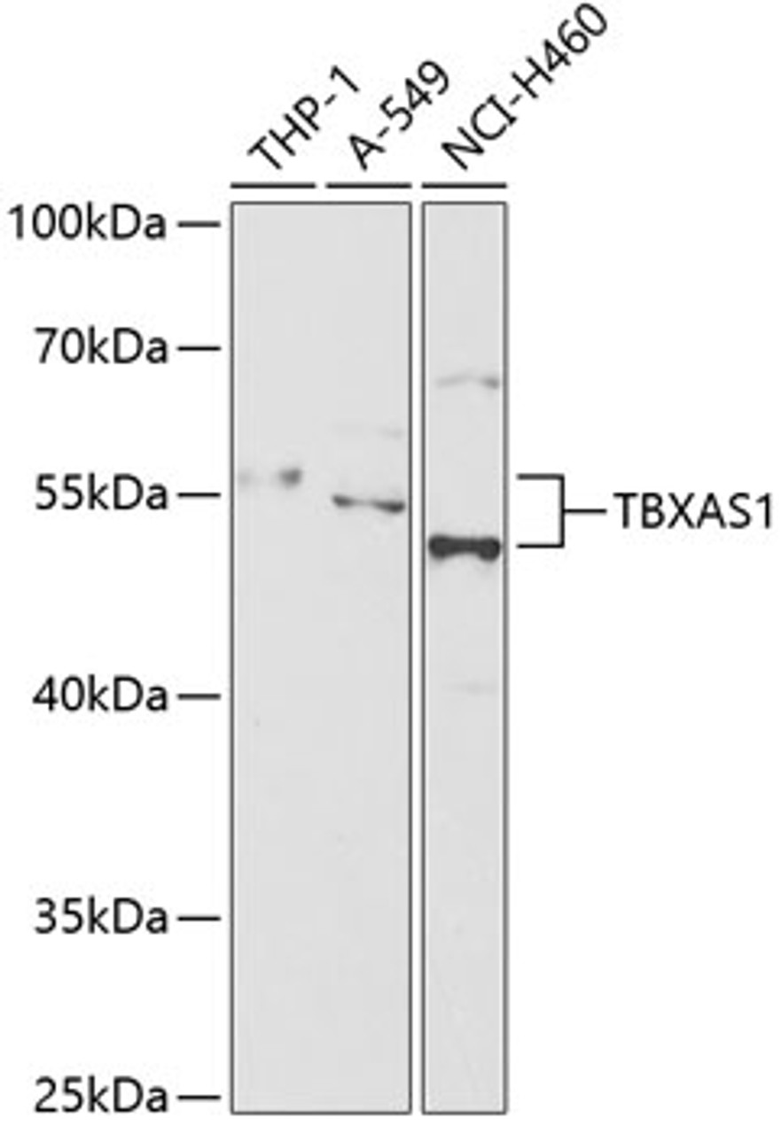 Western blot analysis of extracts of various cell lines, using TBXAS1 antibody (14-947) at 1:1000 dilution.<br/>Secondary antibody: HRP Goat Anti-Rabbit IgG (H+L) at 1:10000 dilution.<br/>Lysates/proteins: 25ug per lane.<br/>Blocking buffer: 3% nonfat dry milk in TBST.<br/>Detection: ECL Basic Kit.<br/>Exposure time: 60s.