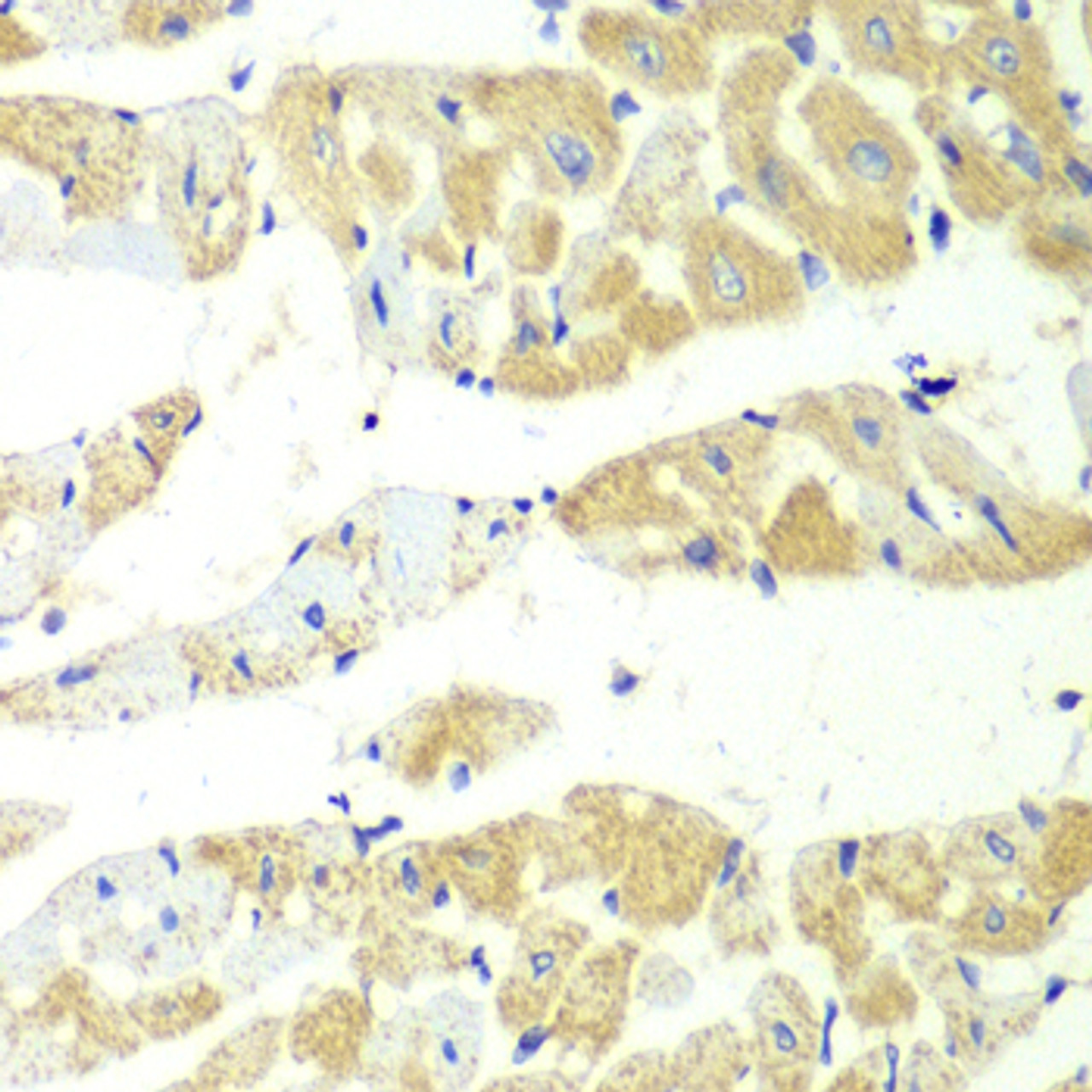 Immunohistochemistry of paraffin-embedded mouse heart using TBXAS1 antibody (14-947) at dilution of 1:100 (40x lens) .