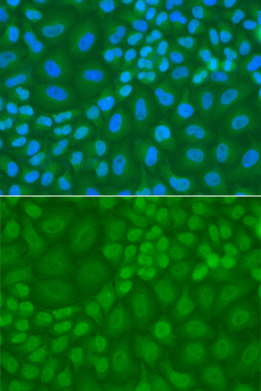 Immunofluorescence analysis of A549 cells using TDG antibody (14-949) . Blue: DAPI for nuclear staining.