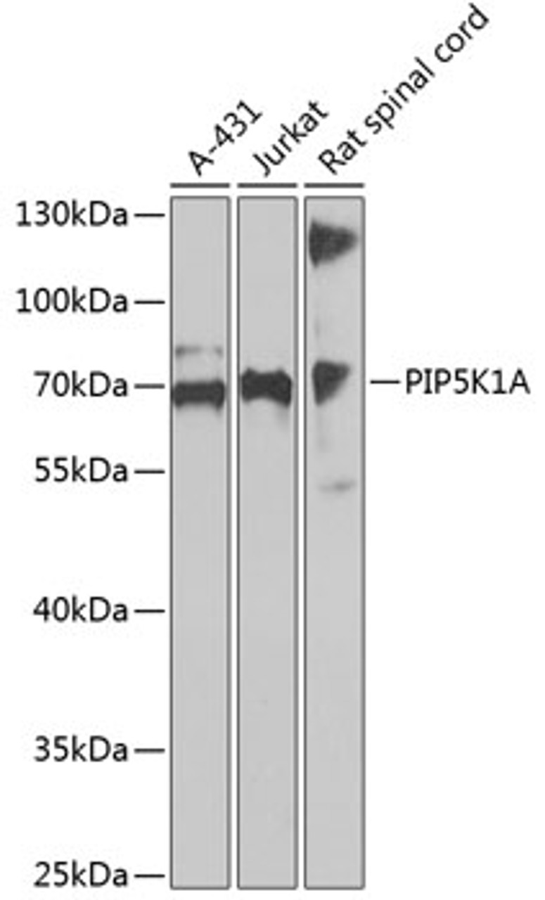 Western blot analysis of extracts of various cell lines, using PIP5K1A antibody (14-955) at 1:1000 dilution.<br/>Secondary antibody: HRP Goat Anti-Rabbit IgG (H+L) at 1:10000 dilution.<br/>Lysates/proteins: 25ug per lane.<br/>Blocking buffer: 3% nonfat dry milk in TBST.<br/>Detection: ECL Basic Kit.<br/>Exposure time: 90s.