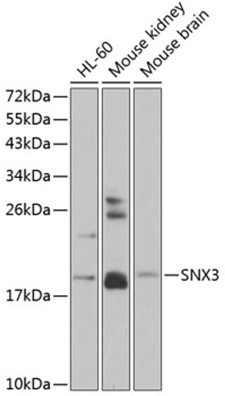 Western blot analysis of extracts of various cell lines, using SNX3 antibody (14-960) at 1:1000 dilution.<br/>Secondary antibody: HRP Goat Anti-Rabbit IgG (H+L) at 1:10000 dilution.<br/>Lysates/proteins: 25ug per lane.<br/>Blocking buffer: 3% nonfat dry milk in TBST.<br/>Detection: ECL Enhanced Kit.<br/>Exposure time: 90s.