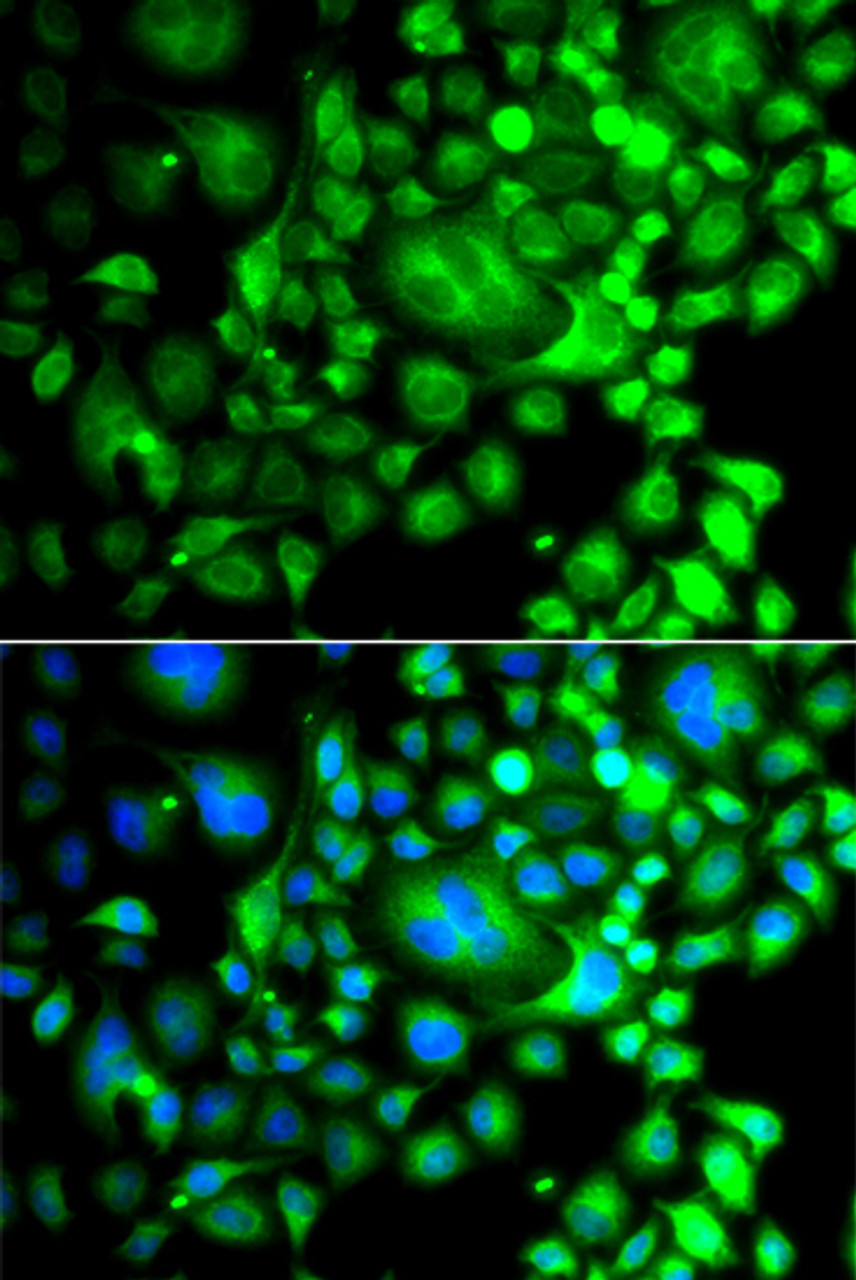 Immunofluorescence analysis of A549 cells using SNX3 antibody (14-960) . Blue: DAPI for nuclear staining.