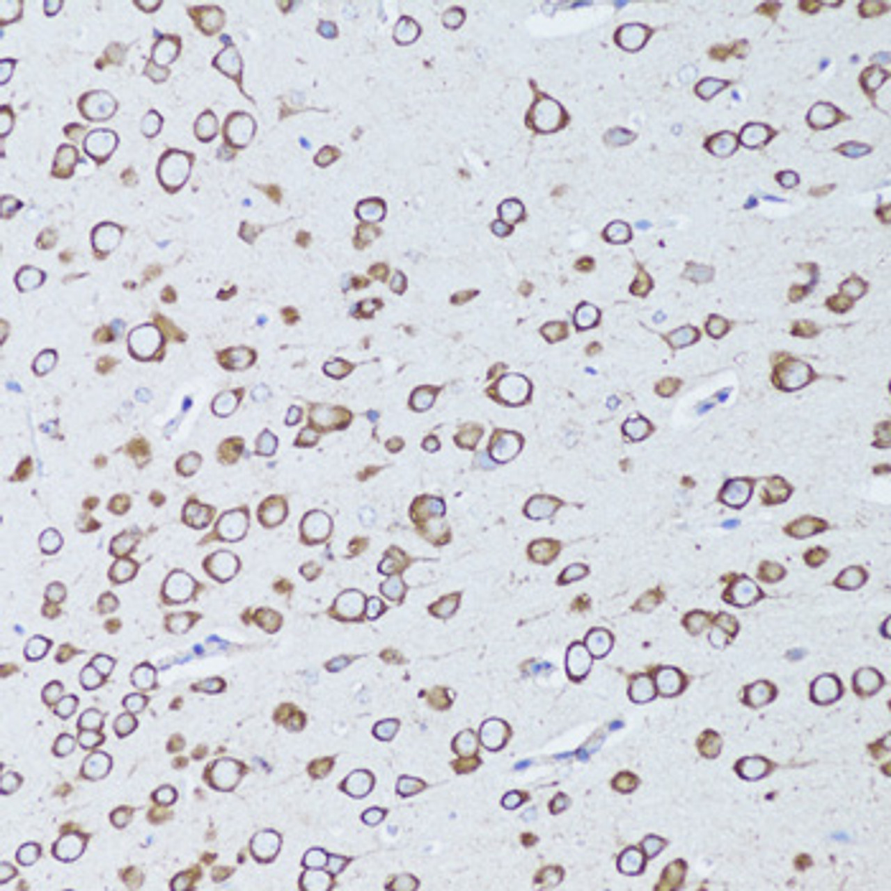 Immunohistochemistry of paraffin-embedded mouse brain using TNFRSF11A antibody (14-961) at dilution of 1:100 (20x lens) .