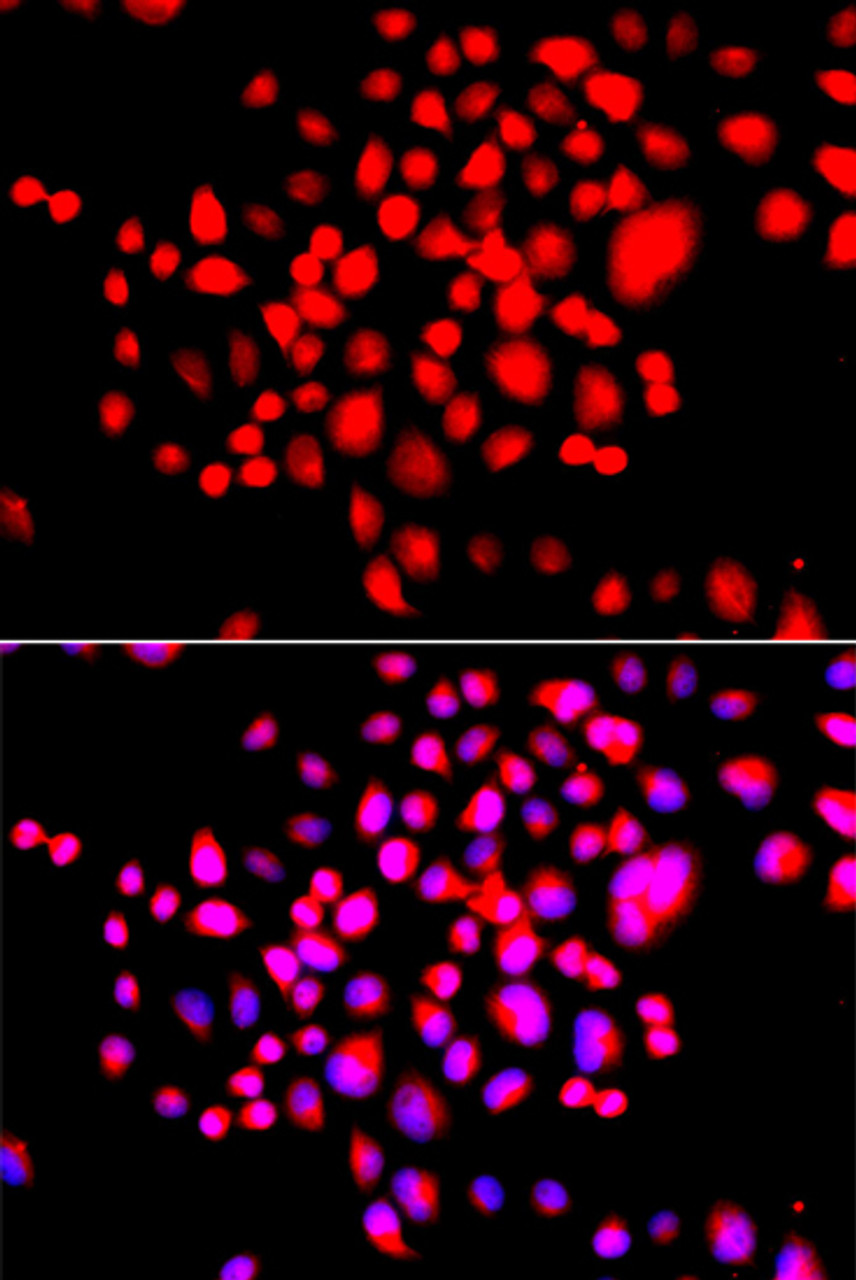 Immunofluorescence analysis of A549 cells using STK19 antibody (14-962) . Blue: DAPI for nuclear staining.