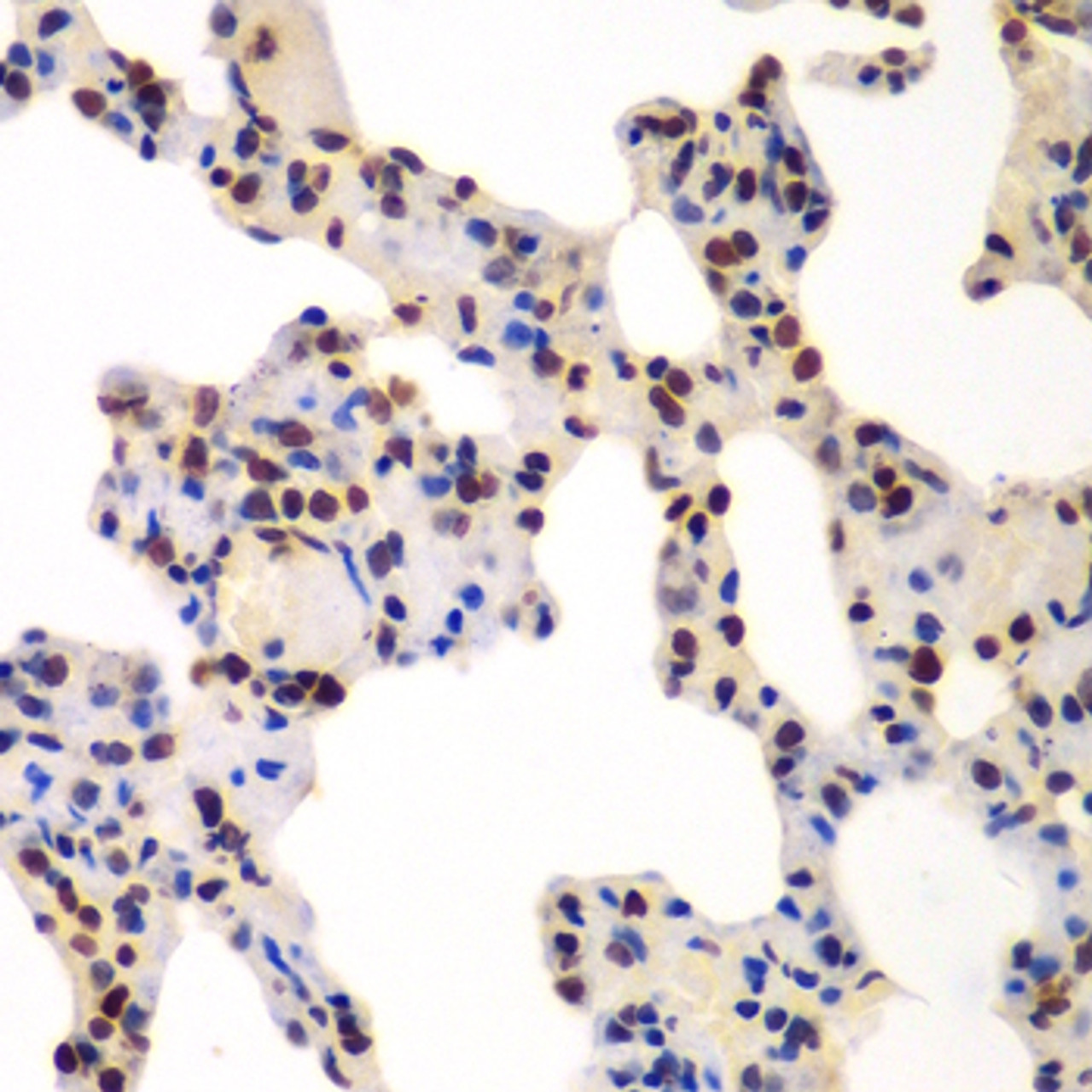 Immunohistochemistry of paraffin-embedded rat lung using GNB2L1 antibody (14-968) at dilution of 1:100 (40x lens) .