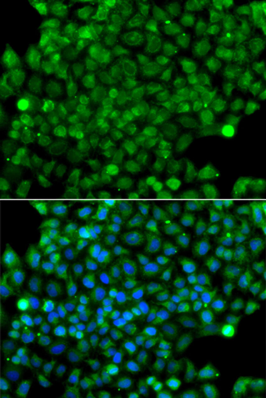 Immunofluorescence analysis of A549 cells using CFHR3 antibody (14-970) . Blue: DAPI for nuclear staining.