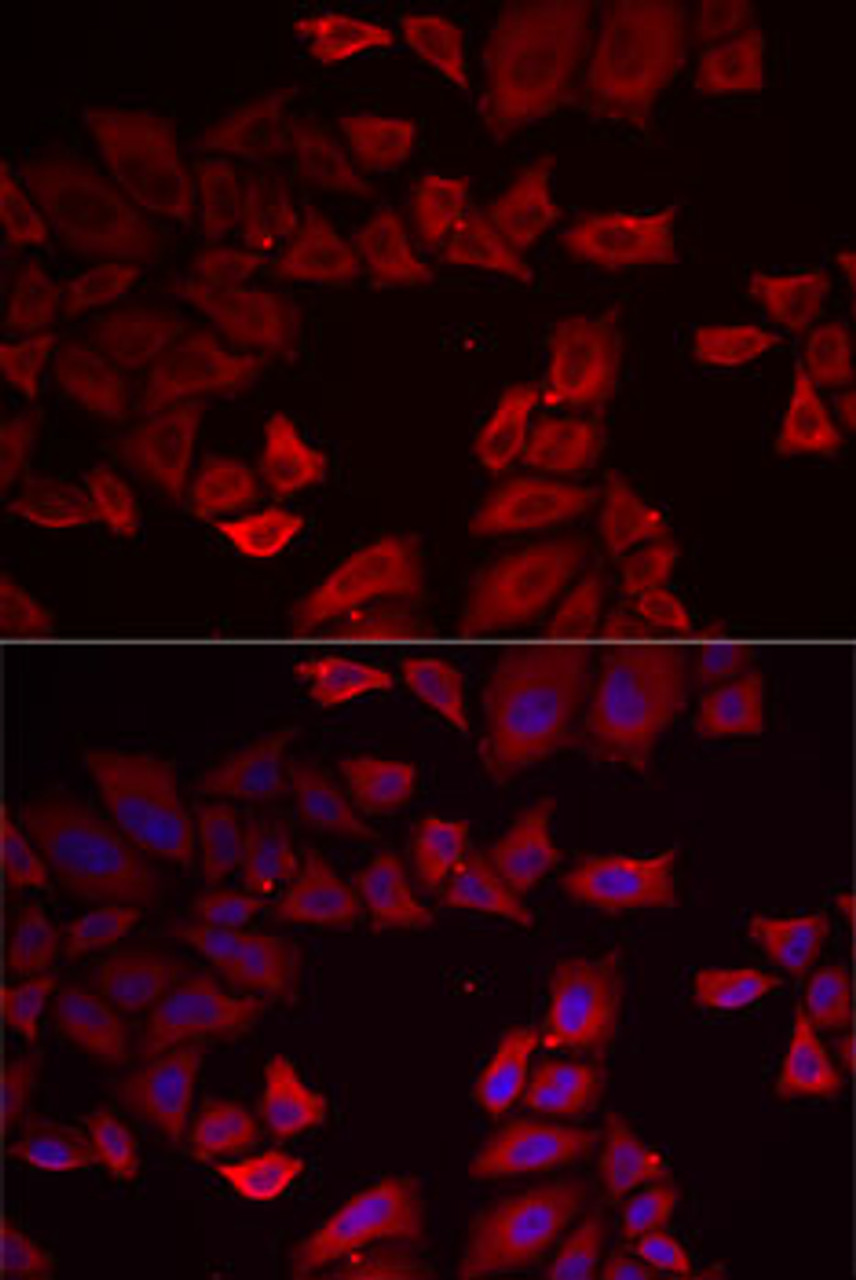 Immunofluorescence analysis of MCF7 cells using SEPHS1 antibody (14-972) . Blue: DAPI for nuclear staining.