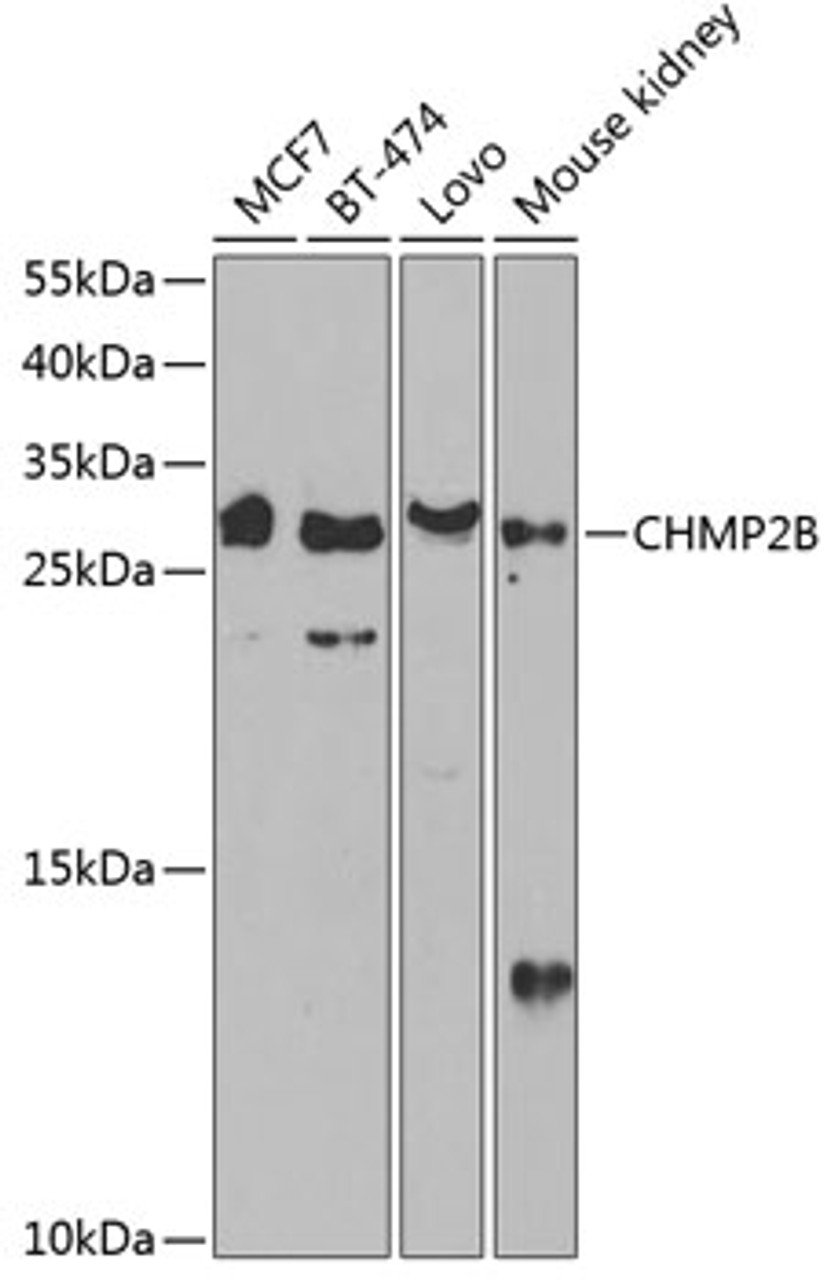 Western blot analysis of extracts of various cell lines, using CHMP2B antibody (14-974) at 1:1000 dilution.<br/>Secondary antibody: HRP Goat Anti-Rabbit IgG (H+L) at 1:10000 dilution.<br/>Lysates/proteins: 25ug per lane.<br/>Blocking buffer: 3% nonfat dry milk in TBST.<br/>Detection: ECL Basic Kit.<br/>Exposure time: 30s.