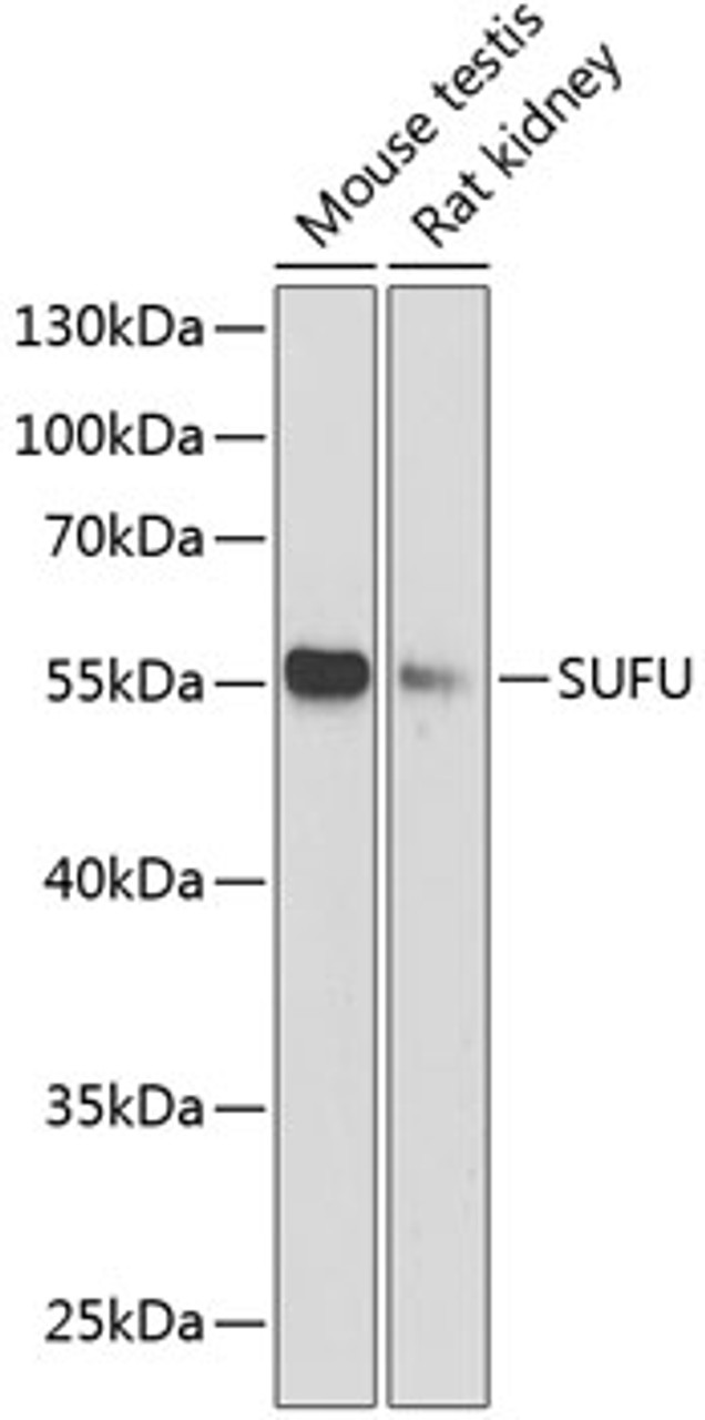 Western blot analysis of extracts of various cell lines, using SUFU antibody (14-985) at 1:1000 dilution.<br/>Secondary antibody: HRP Goat Anti-Rabbit IgG (H+L) at 1:10000 dilution.<br/>Lysates/proteins: 25ug per lane.<br/>Blocking buffer: 3% nonfat dry milk in TBST.<br/>Detection: ECL Basic Kit.<br/>Exposure time: 90s.