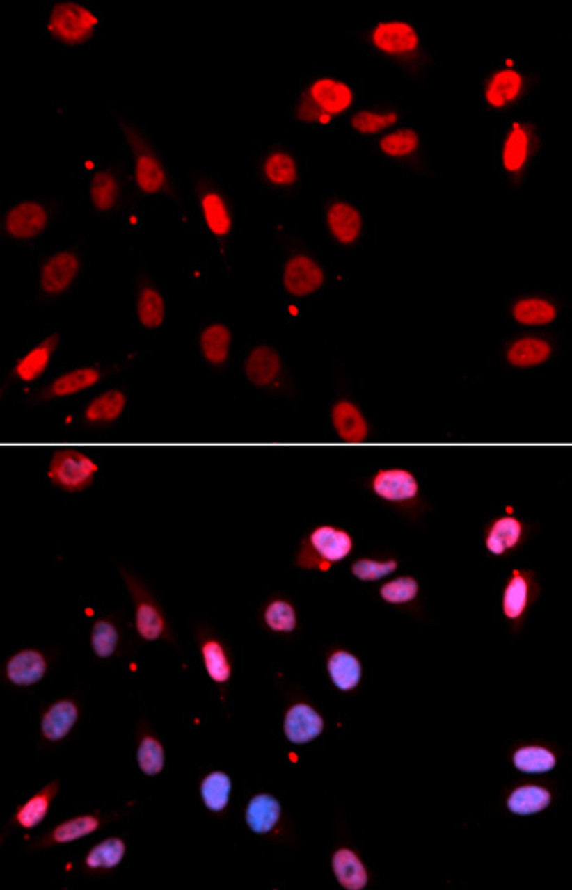 Immunofluorescence analysis of U2OS cells using RAD18 antibody (14-988) . Blue: DAPI for nuclear staining.