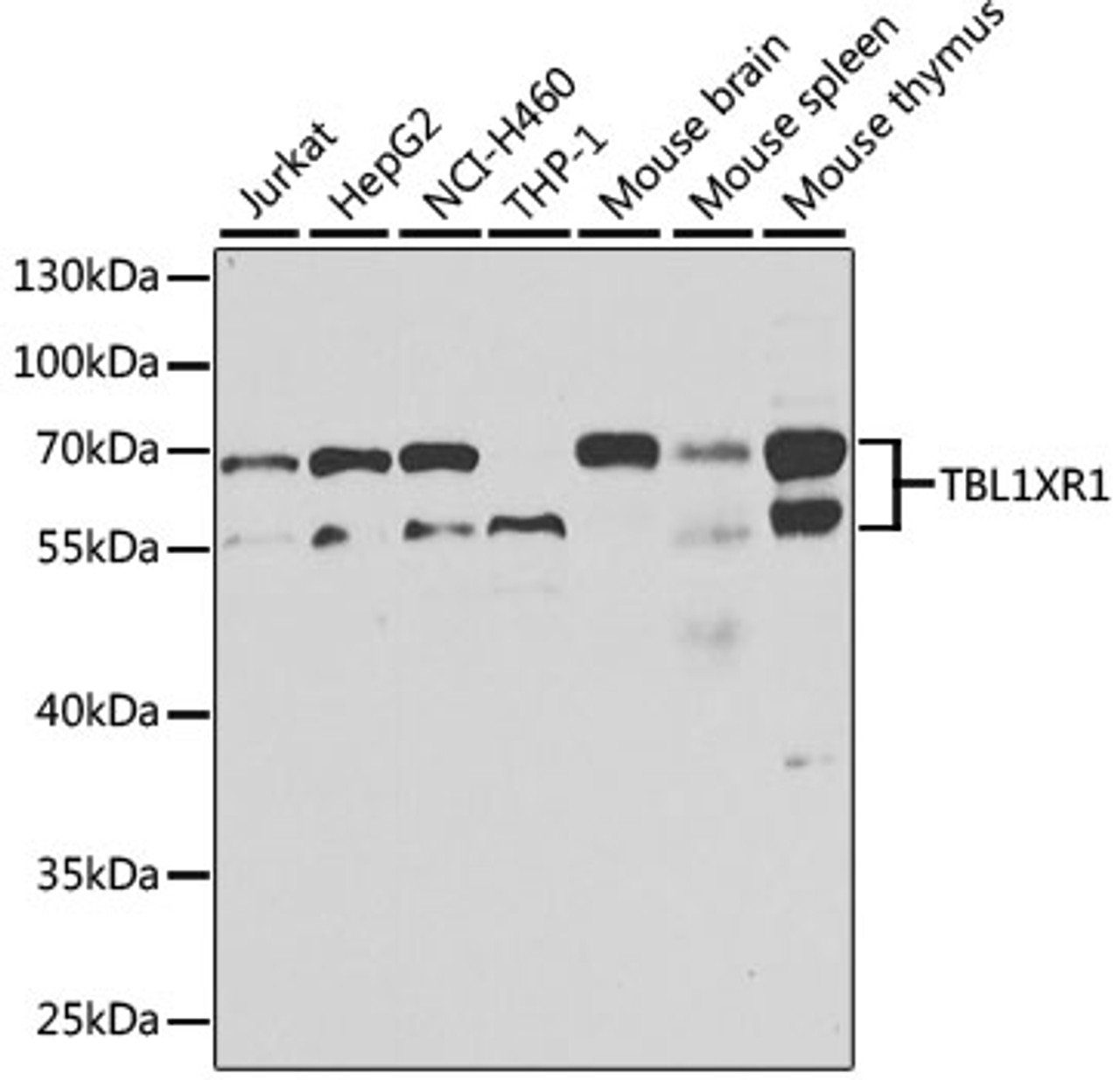 Western blot analysis of extracts of various cell lines, using TBL1XR1 antibody (14-990) at 1:1000 dilution.<br/>Secondary antibody: HRP Goat Anti-Rabbit IgG (H+L) at 1:10000 dilution.<br/>Lysates/proteins: 25ug per lane.<br/>Blocking buffer: 3% nonfat dry milk in TBST.<br/>Detection: ECL Basic Kit.<br/>Exposure time: 10s.