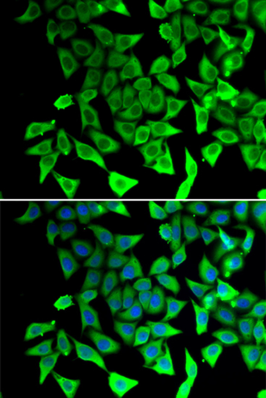 Immunofluorescence analysis of A549 cells using PTGES2 antibody (14-991) . Blue: DAPI for nuclear staining.