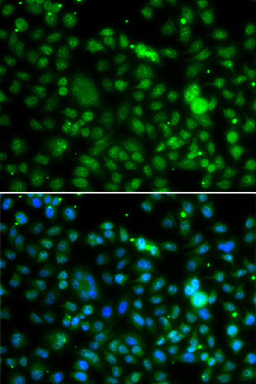 Immunofluorescence analysis of MCF-7 cells using NSUN6 antibody (14-996) . Blue: DAPI for nuclear staining.