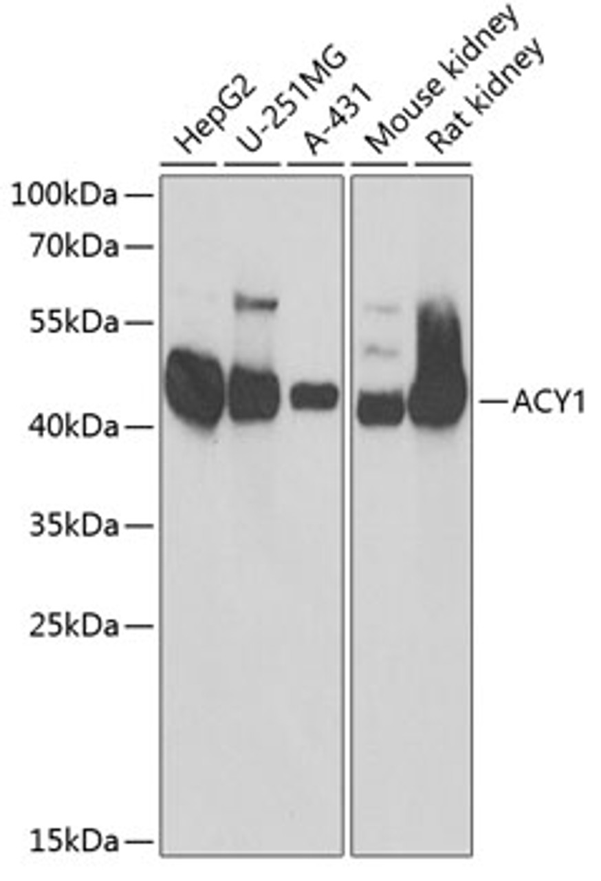Western blot analysis of extracts of various cell lines, using ACY1 antibody (14-999) at 1:1000 dilution.<br/>Secondary antibody: HRP Goat Anti-Rabbit IgG (H+L) at 1:10000 dilution.<br/>Lysates/proteins: 25ug per lane.<br/>Blocking buffer: 3% nonfat dry milk in TBST.