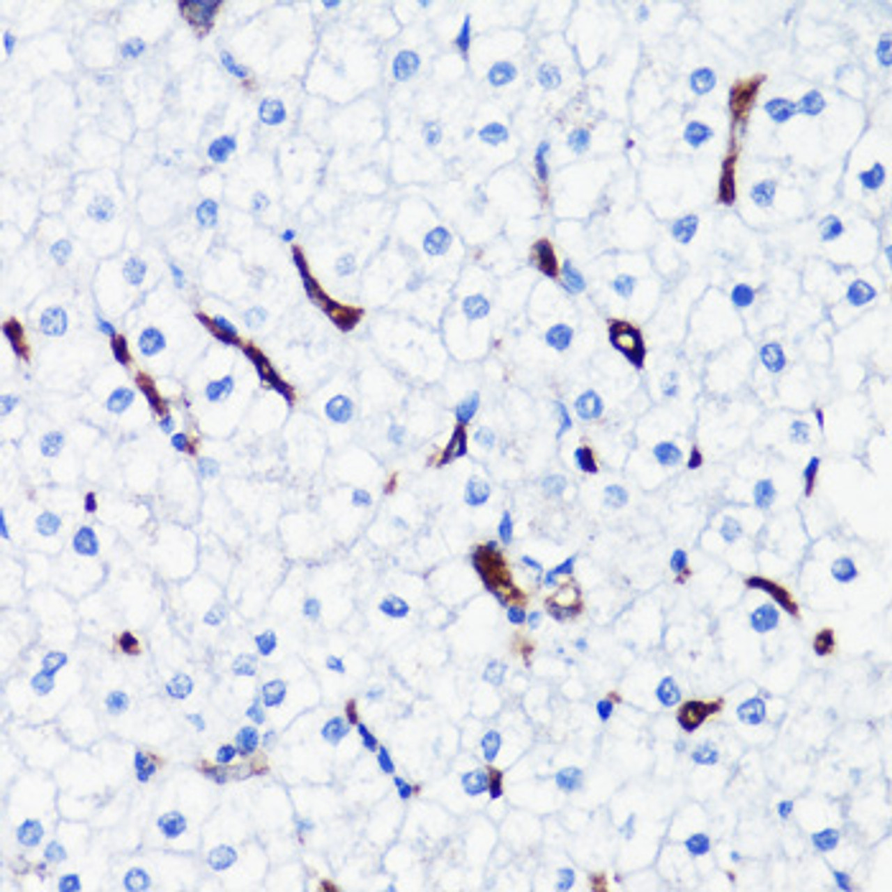 Immunohistochemistry of paraffin-embedded human liver using HO-1 antibody (15-001) at dilution of 1:200 (40x lens) .