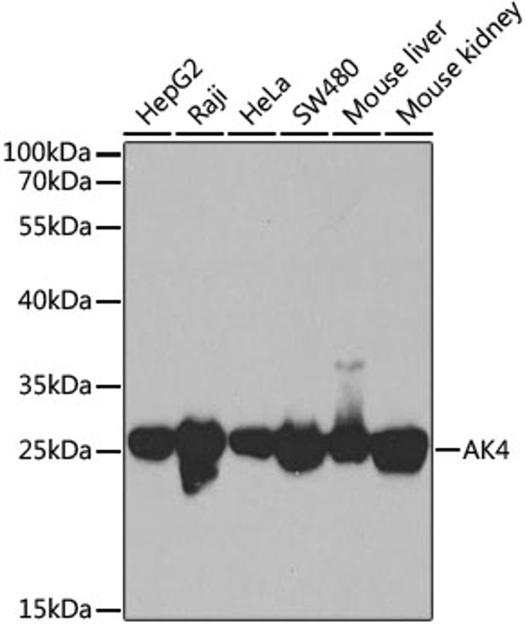 Western blot analysis of extracts of various cell lines, using AK4 antibody (15-003) at 1:1000 dilution.<br/>Secondary antibody: HRP Goat Anti-Rabbit IgG (H+L) at 1:10000 dilution.<br/>Lysates/proteins: 25ug per lane.<br/>Blocking buffer: 3% nonfat dry milk in TBST.