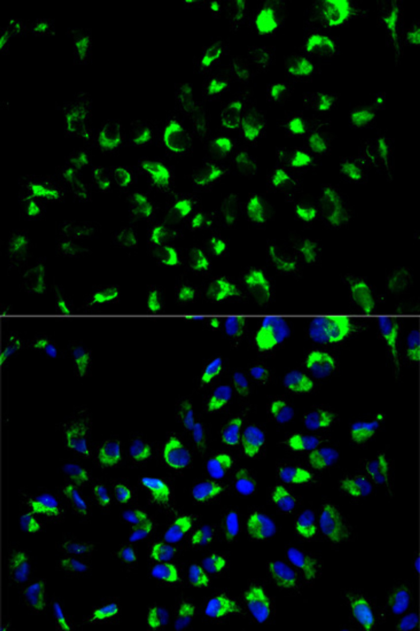 Immunofluorescence analysis of A549 cells using AK4 antibody (15-003) . Blue: DAPI for nuclear staining.