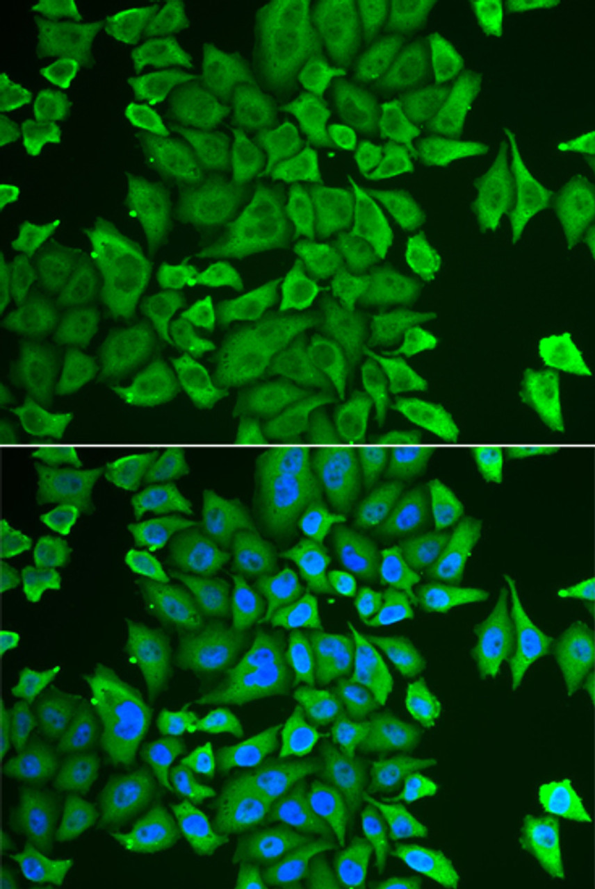 Immunofluorescence analysis of HeLa cells using APEH antibody (15-005) . Blue: DAPI for nuclear staining.