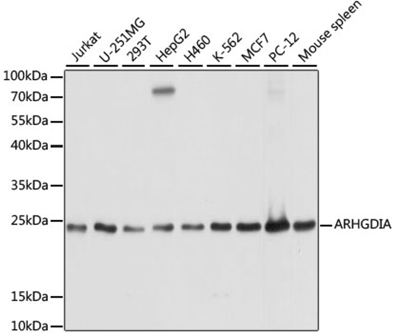 Western blot analysis of extracts of various cell lines, using ARHGDIA antibody (15-006) at 1:1000 dilution.<br/>Secondary antibody: HRP Goat Anti-Rabbit IgG (H+L) at 1:10000 dilution.<br/>Lysates/proteins: 25ug per lane.<br/>Blocking buffer: 3% nonfat dry milk in TBST.<br/>Detection: ECL Basic Kit.<br/>Exposure time: 3s.