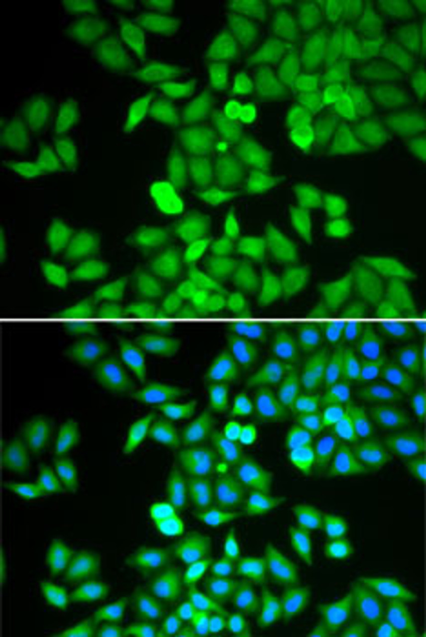 Immunofluorescence analysis of HeLa cells using ARHGDIA antibody (15-006) . Blue: DAPI for nuclear staining.