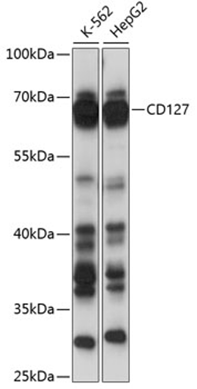 Western blot analysis of extracts of various cell lines, using CD127 antibody (15-029) at 1:1000 dilution.<br/>Secondary antibody: HRP Goat Anti-Rabbit IgG (H+L) at 1:10000 dilution.<br/>Lysates/proteins: 25ug per lane.<br/>Blocking buffer: 3% nonfat dry milk in TBST.<br/>Detection: ECL Basic Kit.<br/>Exposure time: 5s.