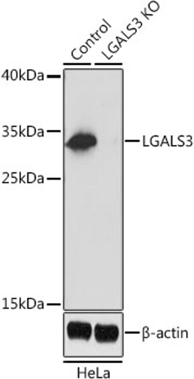 Western blot analysis of extracts from normal (control) and LGALS3 knockout (KO) HeLa cells, using LGALS3 antibody (15-031) at 1:1000 dilution.<br/>Secondary antibody: HRP Goat Anti-Rabbit IgG (H+L) at 1:10000 dilution.<br/>Lysates/proteins: 25ug per lane.<br/>Blocking buffer: 3% nonfat dry milk in TBST.<br/>Detection: ECL Basic Kit.<br/>Exposure time: 1s.