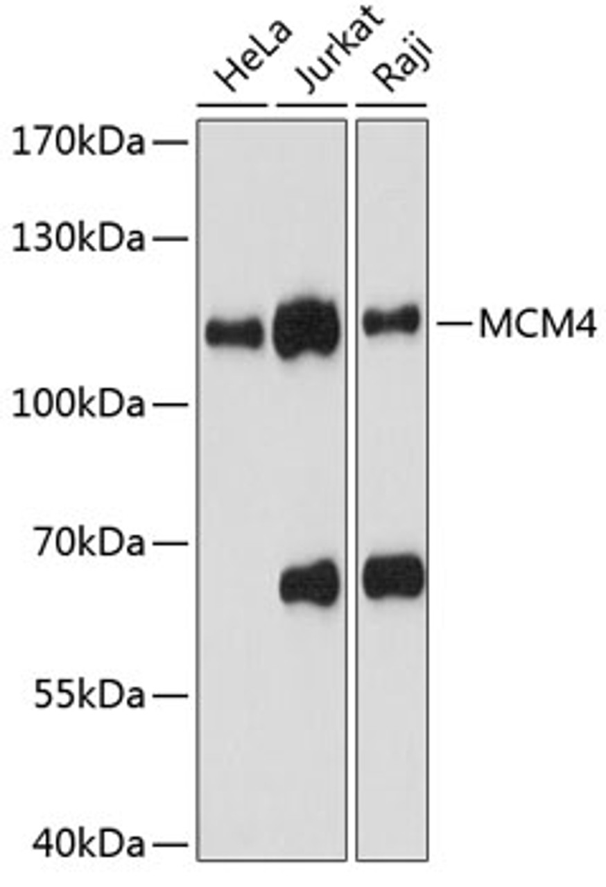 Western blot analysis of extracts of various cell lines, using MCM4 antibody (15-035) at 1:1000 dilution.<br/>Secondary antibody: HRP Goat Anti-Rabbit IgG (H+L) at 1:10000 dilution.<br/>Lysates/proteins: 25ug per lane.<br/>Blocking buffer: 3% nonfat dry milk in TBST.<br/>Detection: ECL Basic Kit.<br/>Exposure time: 30s.