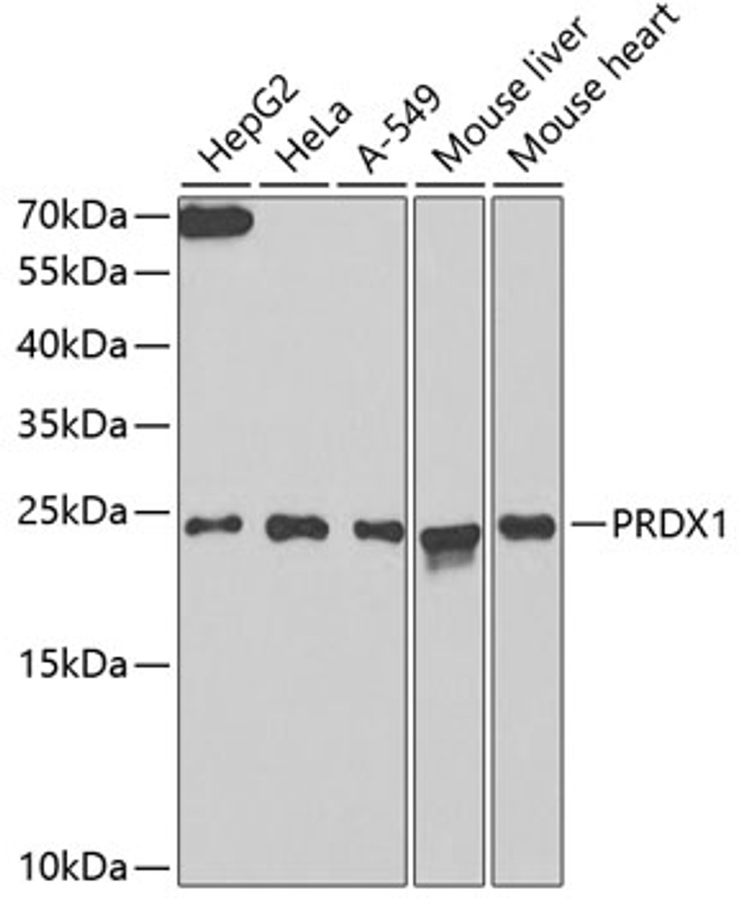Western blot analysis of extracts of various cell lines, using PRDX1 antibody (15-042) at 1:1000 dilution.<br/>Secondary antibody: HRP Goat Anti-Rabbit IgG (H+L) at 1:10000 dilution.<br/>Lysates/proteins: 25ug per lane.<br/>Blocking buffer: 3% nonfat dry milk in TBST.