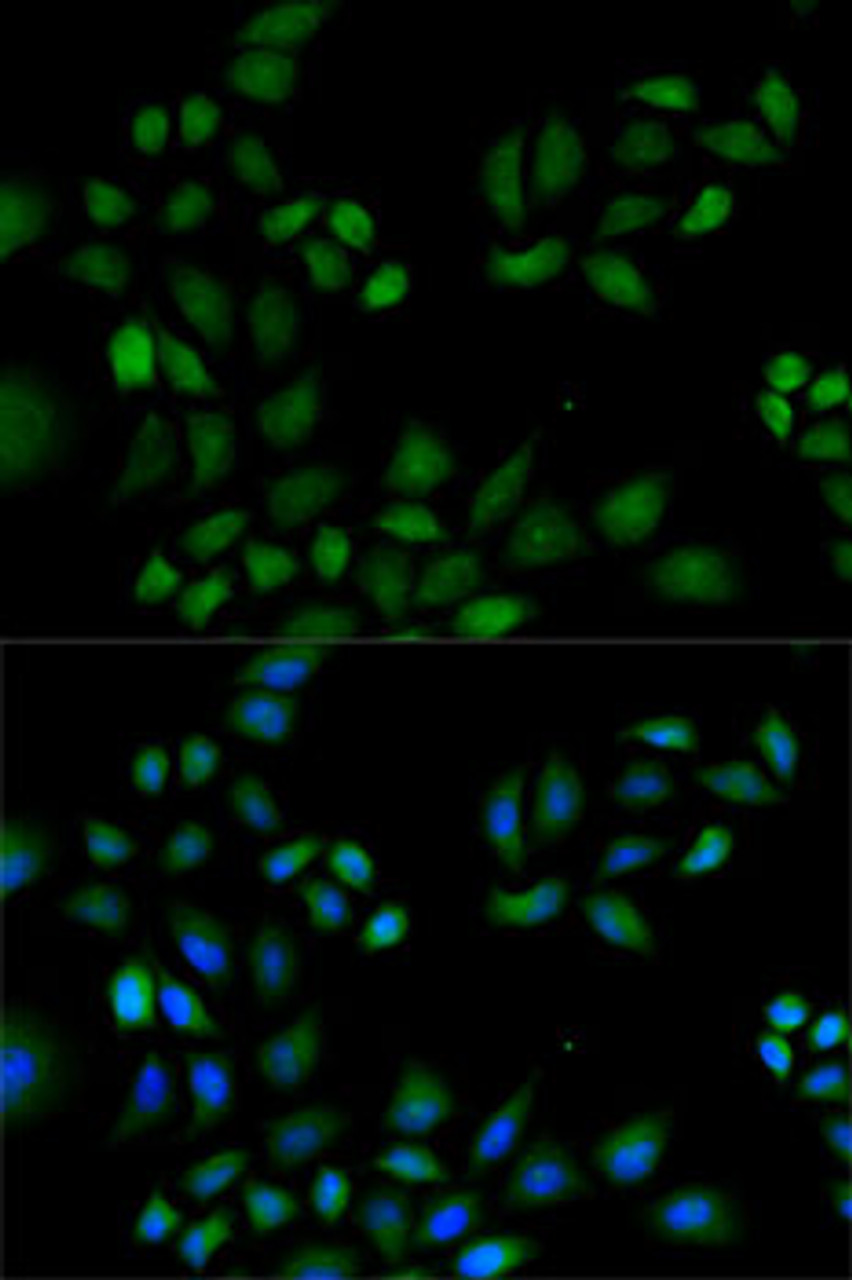 Immunofluorescence analysis of HeLa cells using PRDX1 antibody (15-042) . Blue: DAPI for nuclear staining.