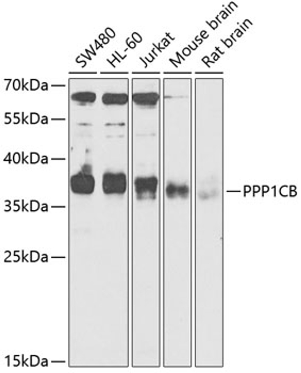 Western blot analysis of extracts of various cell lines, using PPP1CB antibody (15-046) at 1:1000 dilution.<br/>Secondary antibody: HRP Goat Anti-Rabbit IgG (H+L) at 1:10000 dilution.<br/>Lysates/proteins: 25ug per lane.<br/>Blocking buffer: 3% nonfat dry milk in TBST.<br/>Detection: ECL Enhanced Kit.<br/>Exposure time: 60s.