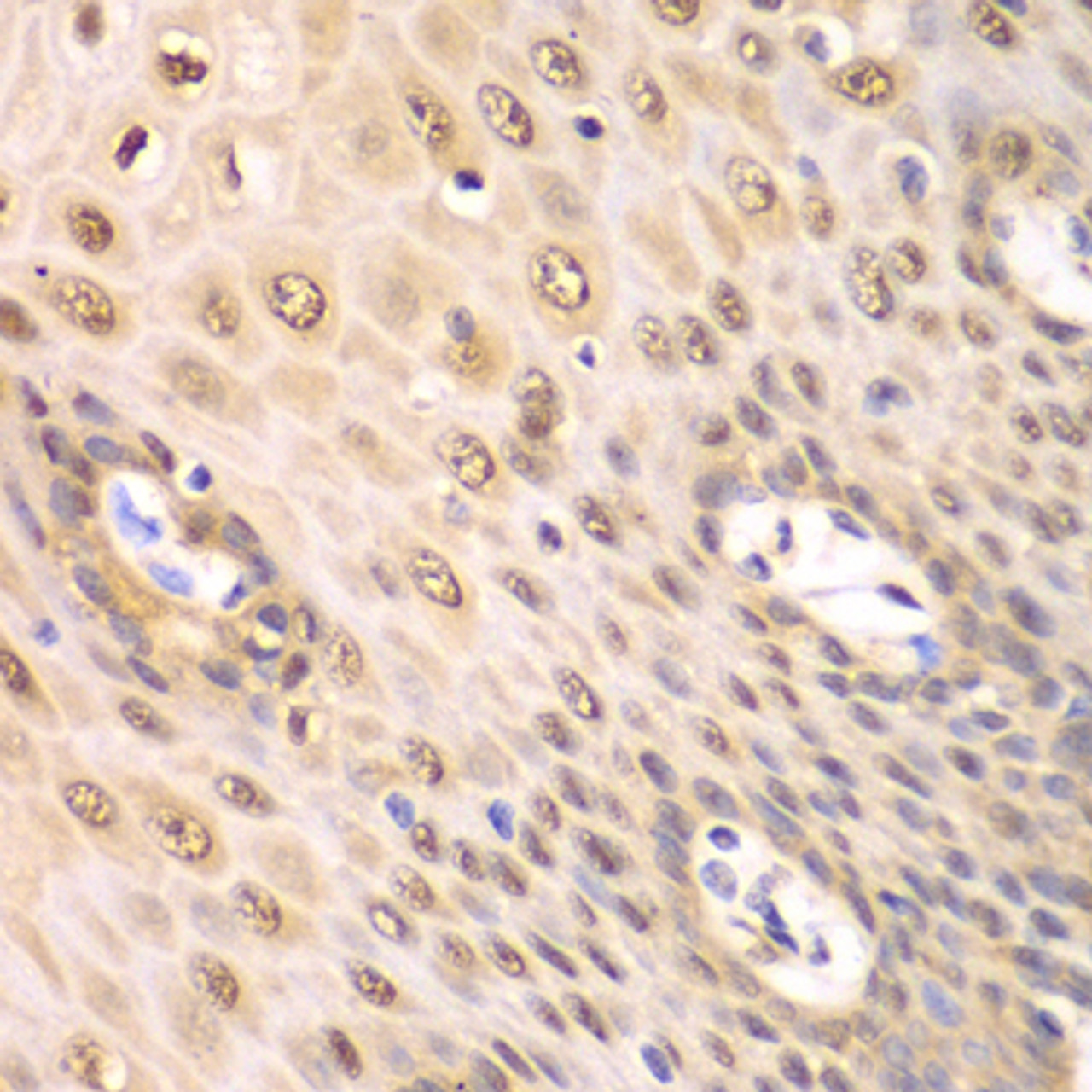 Immunohistochemistry of paraffin-embedded human esophagus using PSMA2 antibody (15-049) at dilution of 1:100 (40x lens) .