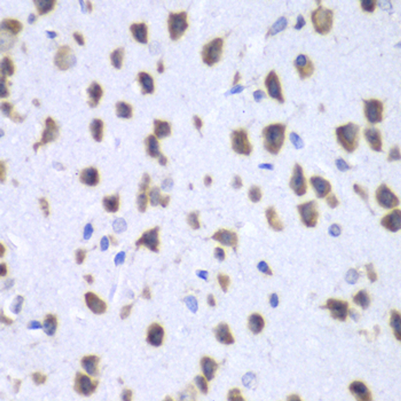Immunohistochemistry of paraffin-embedded mouse brain using UPF1 antibody (15-057) at dilution of 1:100 (40x lens) .