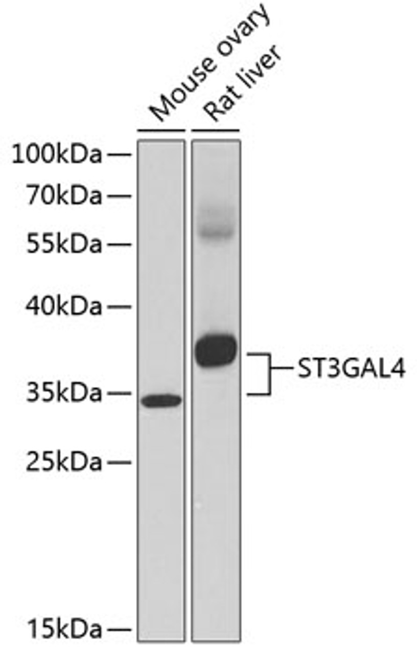 Western blot analysis of extracts of various cell lines, using ST3GAL4 antibody (15-059) at 1:1000 dilution.<br/>Secondary antibody: HRP Goat Anti-Rabbit IgG (H+L) at 1:10000 dilution.<br/>Lysates/proteins: 25ug per lane.<br/>Blocking buffer: 3% nonfat dry milk in TBST.<br/>Detection: ECL Enhanced Kit.<br/>Exposure time: 60s.