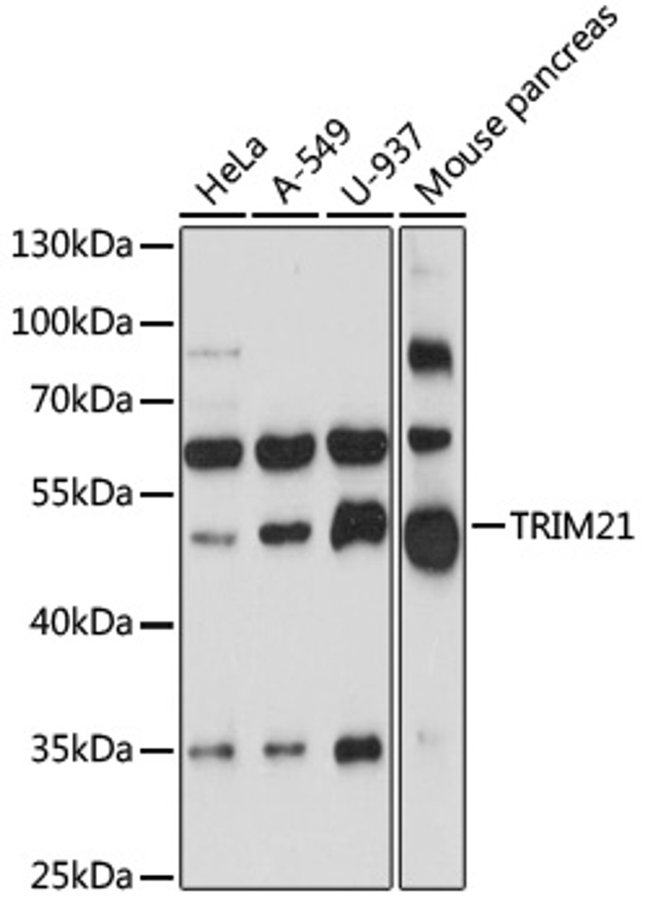 Western blot analysis of extracts of various cell lines, using TRIM21 antibody (15-060) at 1:1000 dilution.<br/>Secondary antibody: HRP Goat Anti-Rabbit IgG (H+L) at 1:10000 dilution.<br/>Lysates/proteins: 25ug per lane.<br/>Blocking buffer: 3% nonfat dry milk in TBST.<br/>Detection: ECL Basic Kit.<br/>Exposure time: 90s.